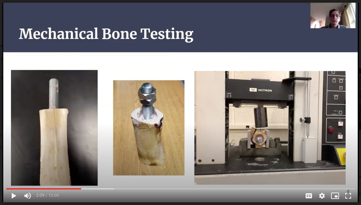 Screenshot of presentation about development of prosthetic device